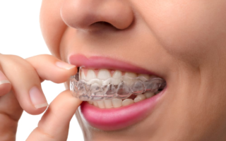 Dentist Clinton Can Advise on Whether to Go For Dentures or Dental Implants