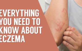 Everything you need to know about eczema