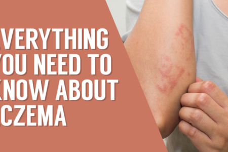 Everything you need to know about eczema