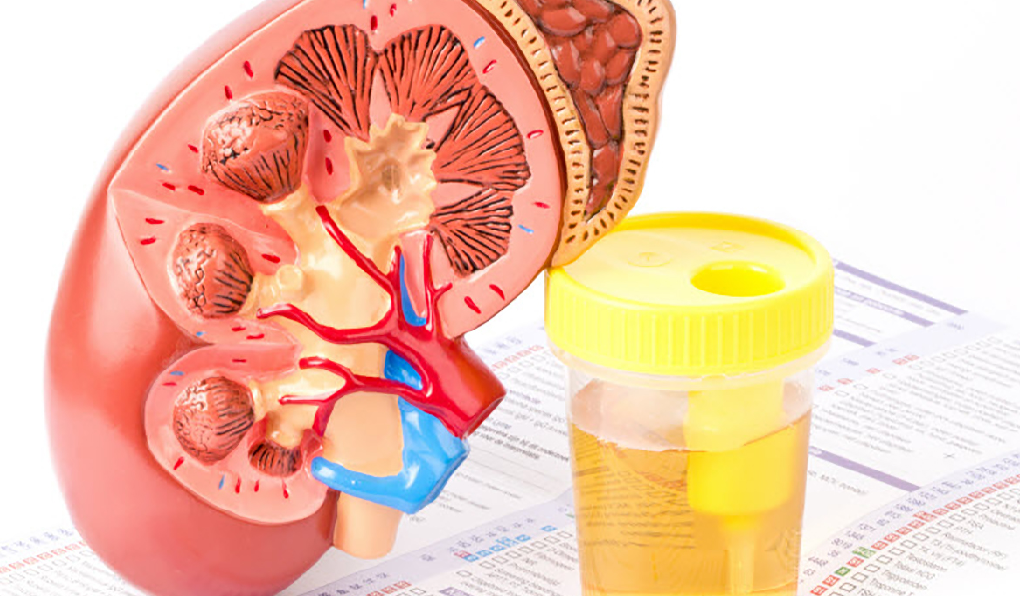 Detection of kidney disorders through urine collection