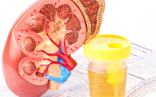 Detection of kidney disorders through urine collection