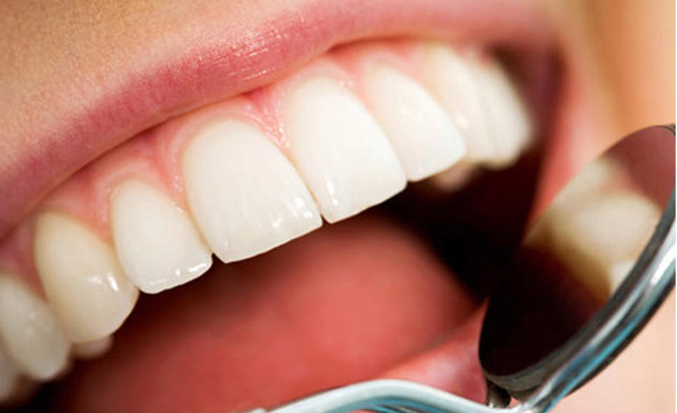 Suggestions to Avoid Coffee Stains on Teeth