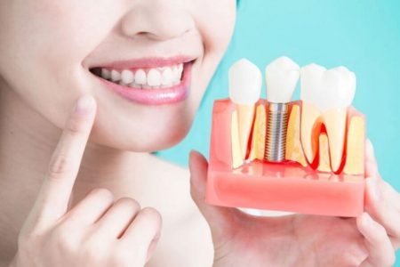 Are Dental Implants Right for Your Smile