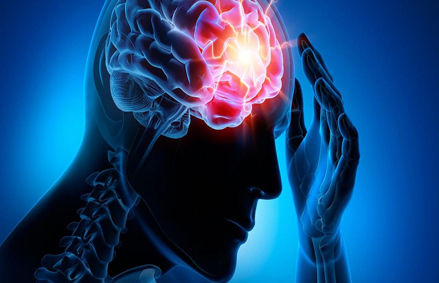 Causes and Treatment of Epilepsy