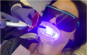 Why Should You Get Your Teeth Professionally Whitened