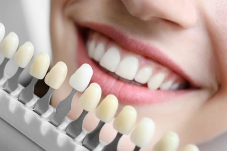 Dental Implant is an Ideal Restoration