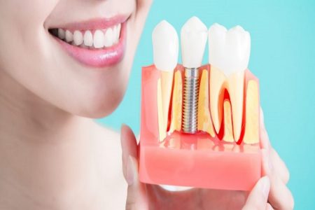 Get the Best Dental Treatment Benefits from Dental Implant Clinic