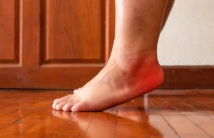 Plantar fasciitis disorder