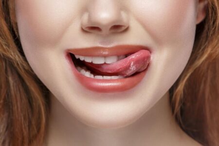 Untreated Gum Disease