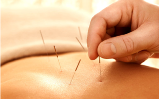Acupuncture Before Visiting a Clinic in Richmond