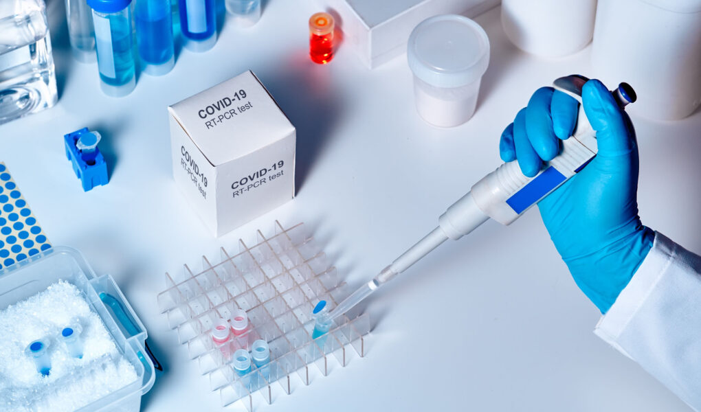 5 Criteria that you should check before selecting the right RTPCR testing lab for you
