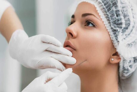 Thread Embedding in Medical Cosmetology